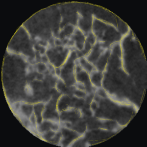 Bézier curves identifying alveolar bone structures