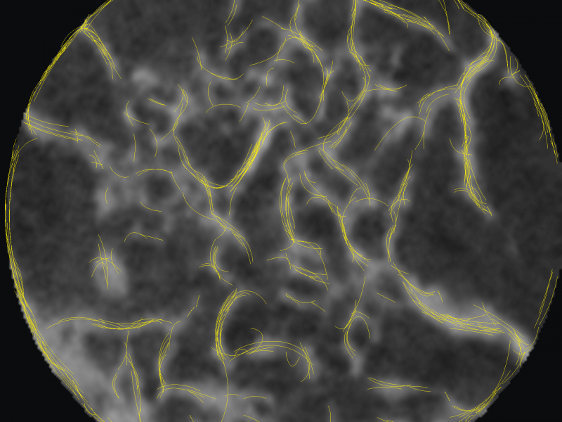 Bézier curves identifying alveolar bone structures