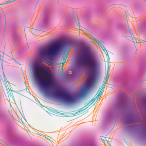 Bézier curves being used to assign a figure of merit in kidney nuclei