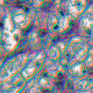 Kidney tissue with all Bézier curves displayed at three thresholds and four resolutions along with ellipses outlining targeted nuclei