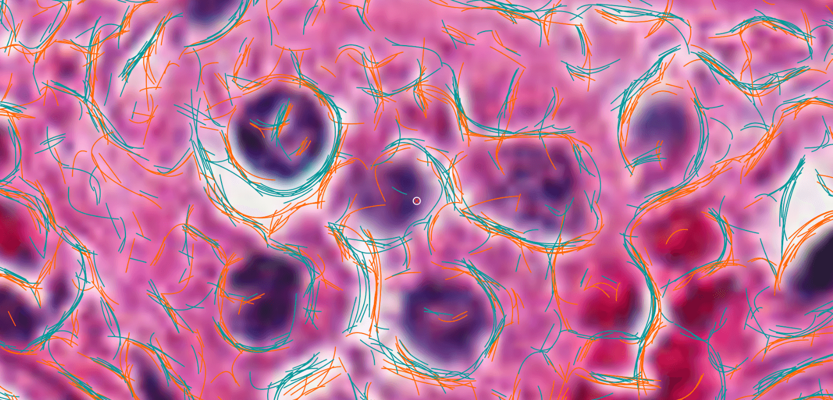 Bézier curves encircling pleomorphic cells